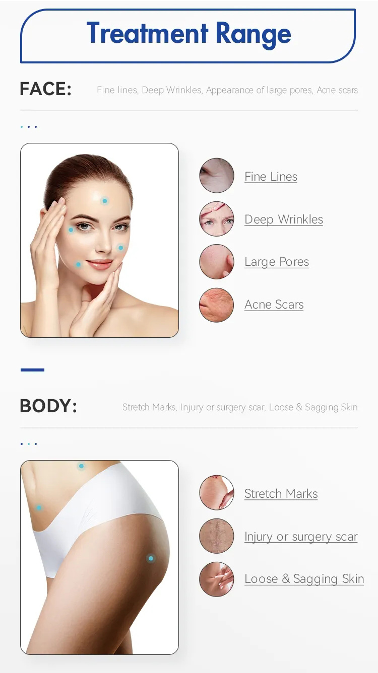 Portable Facial Lift Radio Frequency Fractional Micro Needling Beauty Equipment Rf Microneedling Machine