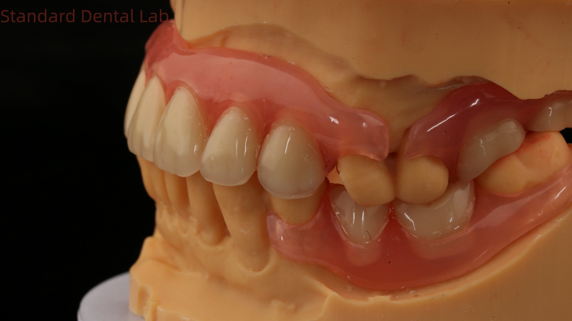 3D Print Model Dental TCS Valplast Flexible Partial Dentures Pink / Dark Color Dental Lab Product