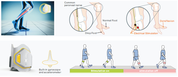 Modern Walking Aidsfoot Drop Machine FES XFT-2001D For Lower Limb Gait Orthosis