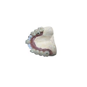 Quality Accurate Biocompatibility Dental Implant Attachments Tooth Implant Crown for sale