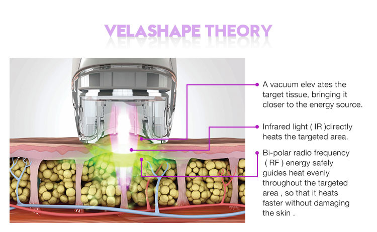 20MHZ 100kPa 940nm Vacuum Roller Slimming Machine