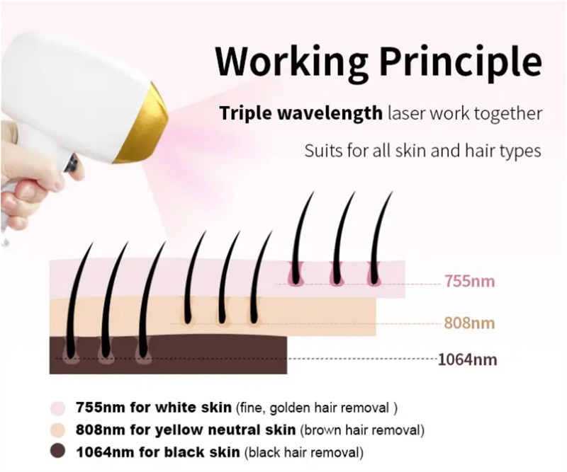 Multifunctional 3 In 1 808nm Diode Laser Hair Removal Tattoo Removal