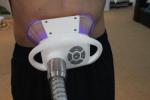Non-invasive 2 Handles Vacuum Cryolipolysis Body Quick Slimming Machine